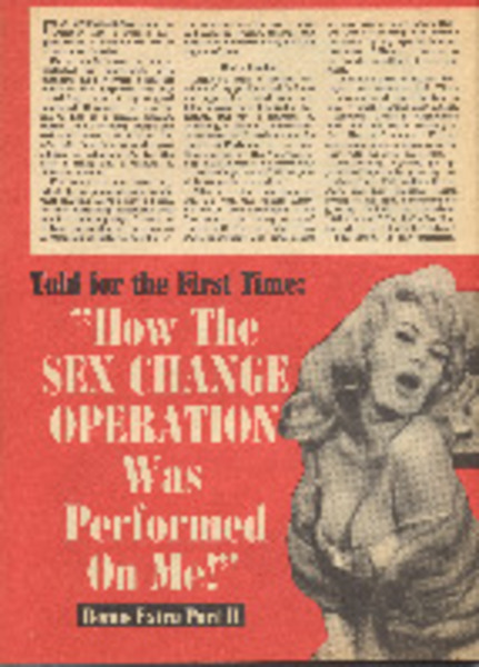 Download the full-sized image of Told for the First Time: "How the Sex Change Operation Was Performed On Me!"
